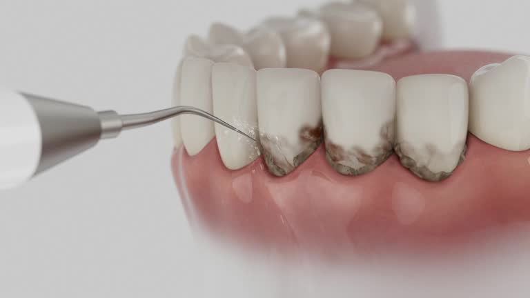 Trusted Dental Implants service in Fort Hunt, VA - Dentist Open Now
